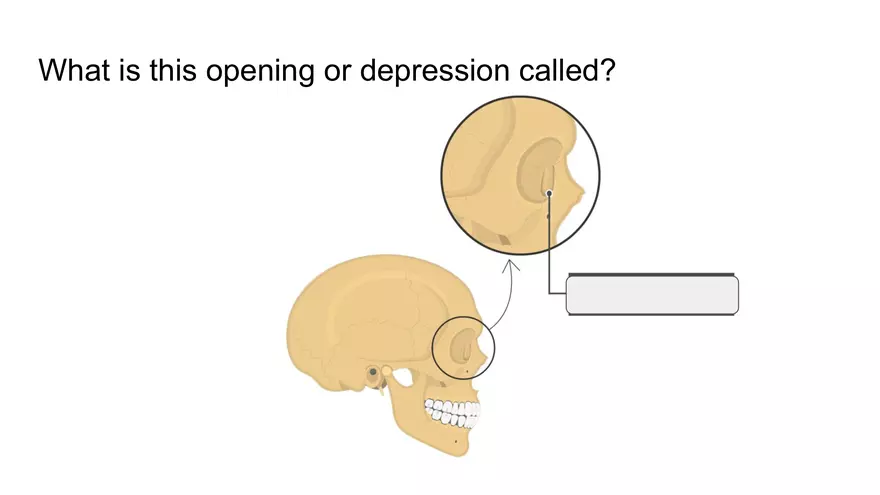 Bone Project Presentation - Page 9