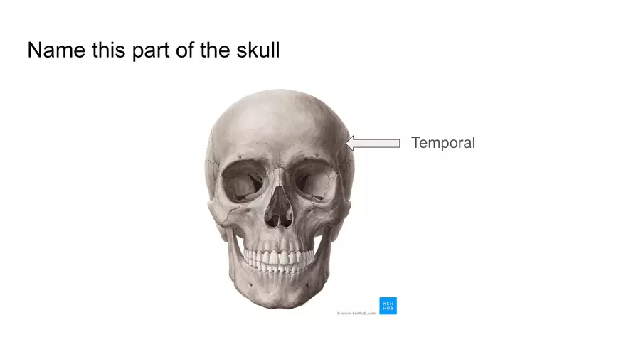 Bone Project Presentation - Page 11