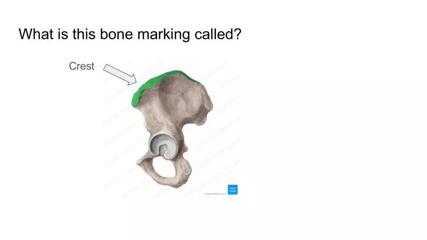 Bone Project Presentation - Page 13