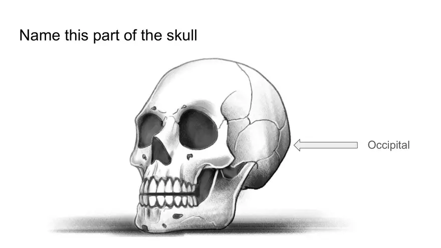 Bone Project Presentation - Page 14