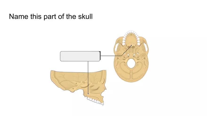 Bone Project Presentation - Page 19