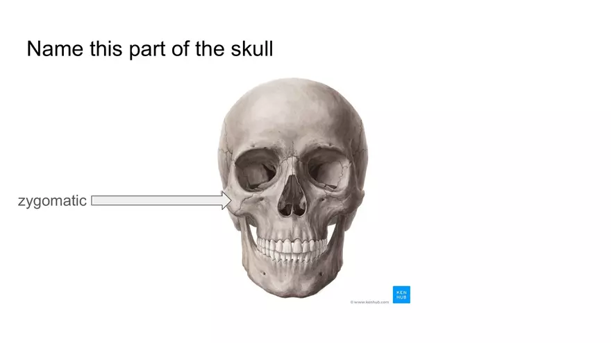 Bone Project Presentation - Page 20
