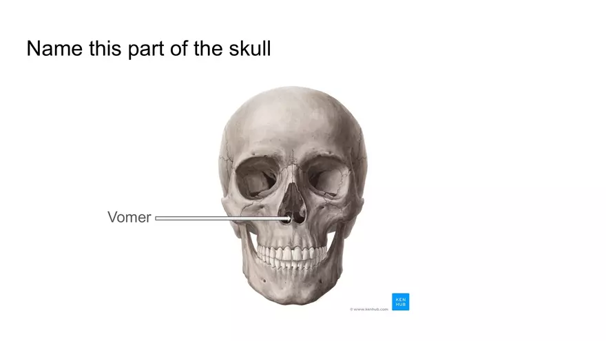 Bone Project Presentation - Page 23