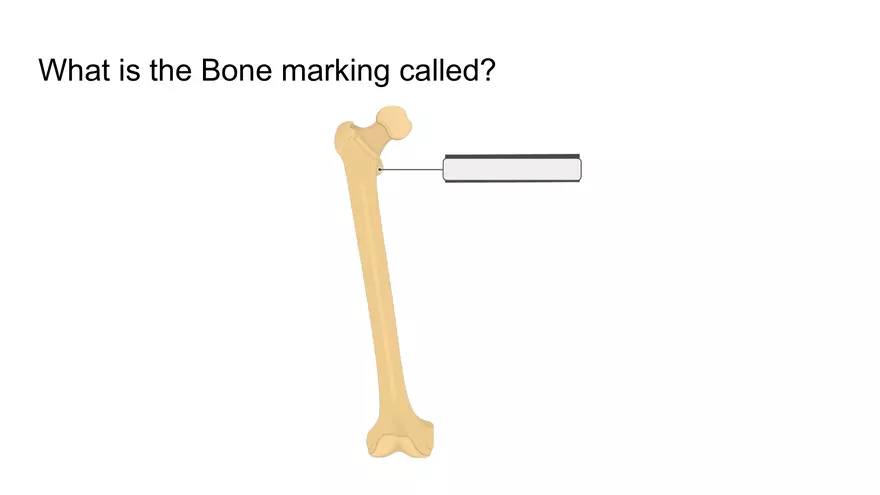 Bone Project Presentation - Page 24