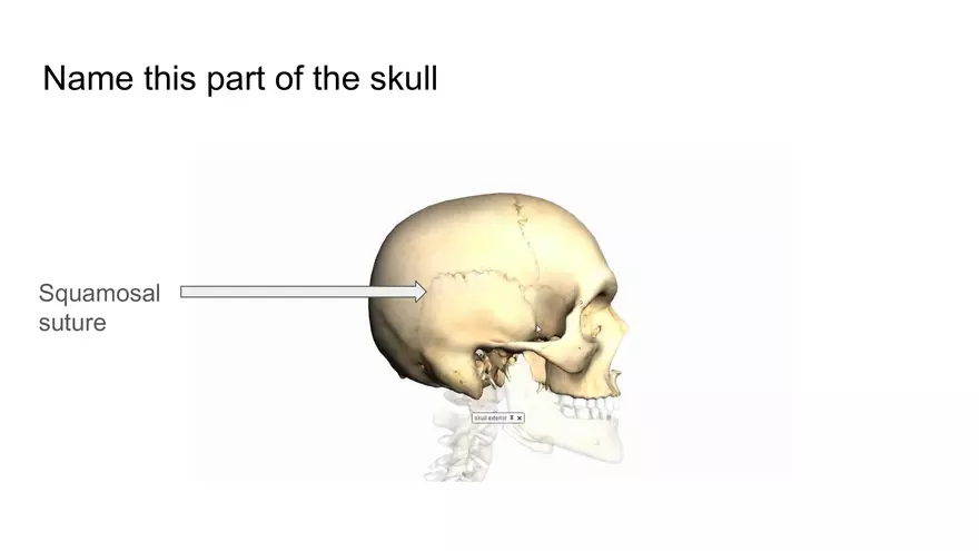 Bone Project Presentation - Page 25