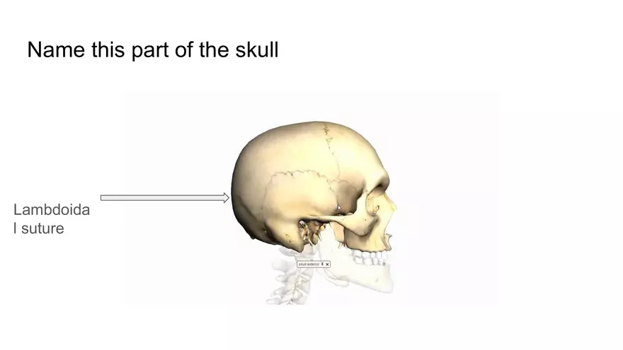 Bone Project Presentation - Page 26