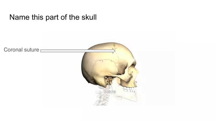 Bone Project Presentation - Page 27