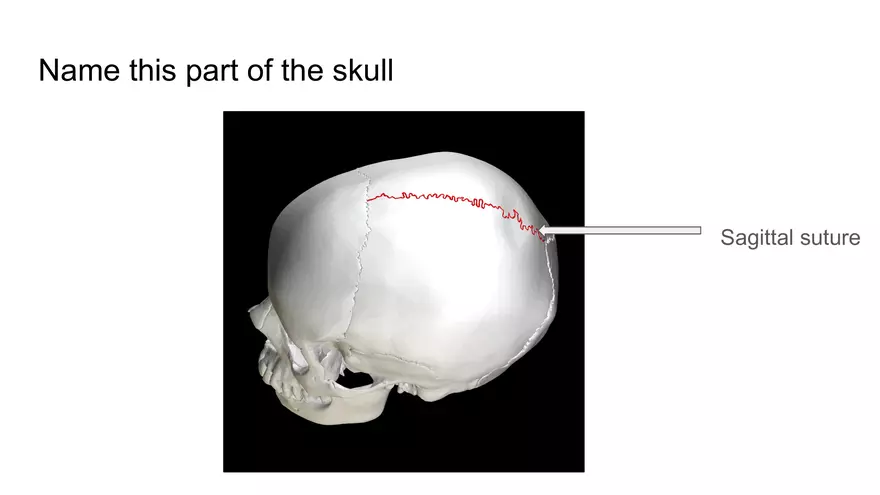 Bone Project Presentation - Page 28
