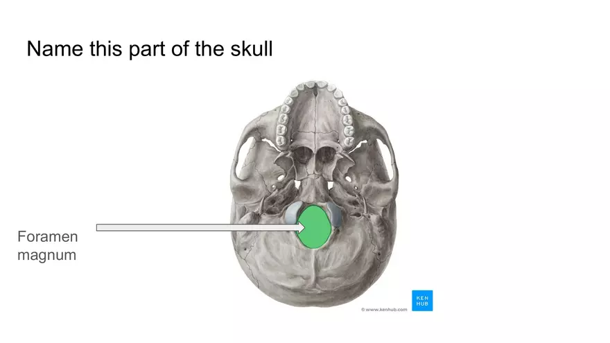 Bone Project Presentation - Page 29