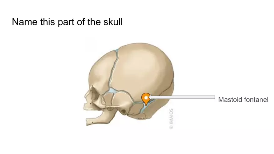 Bone Project Presentation - Page 31