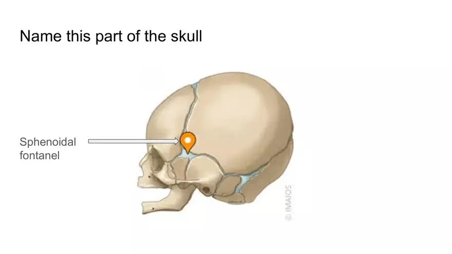 Bone Project Presentation - Page 32