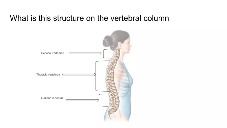 Bone Project Presentation - Page 33