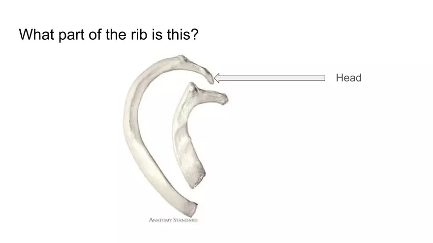 Bone Project Presentation - Page 45