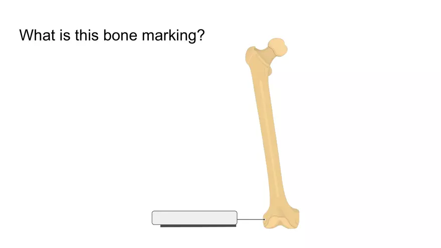 Bone Project Presentation - Page 46