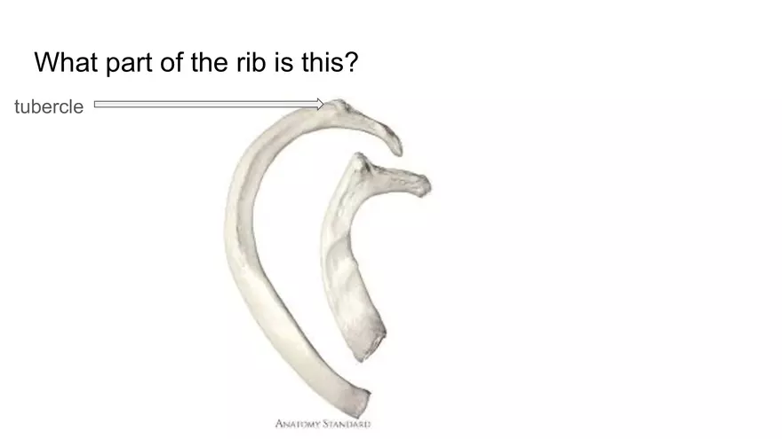 Bone Project Presentation - Page 47