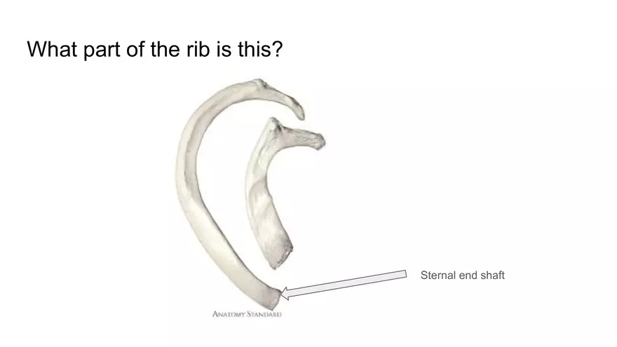 Bone Project Presentation - Page 50