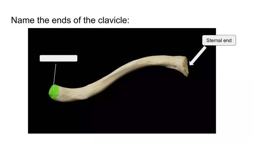 Bone Project Presentation - Page 56