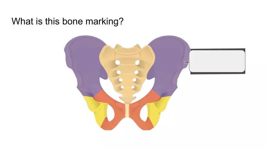 Bone Project Presentation - Page 57