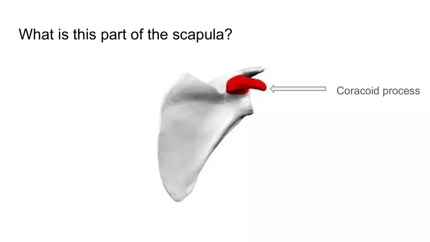 Bone Project Presentation - Page 59