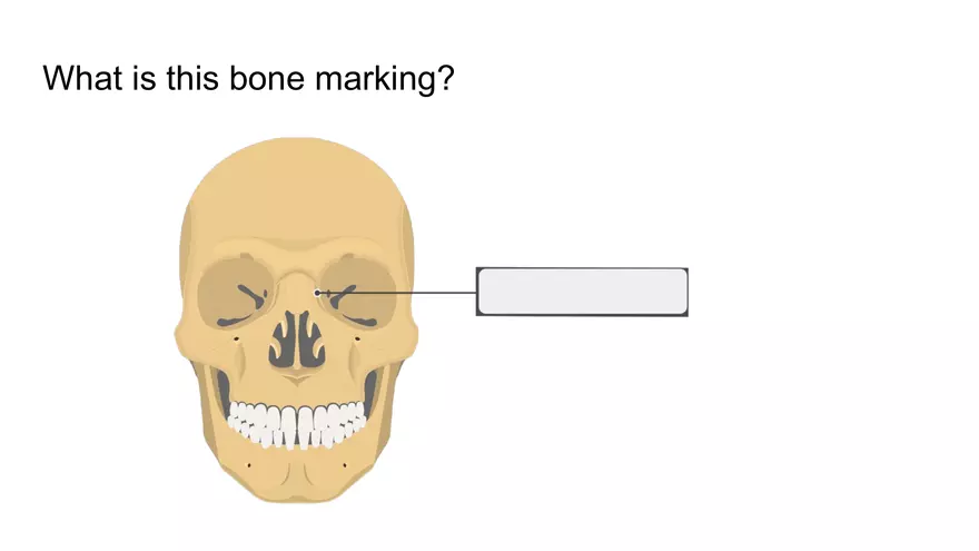 Bone Project Presentation - Page 68