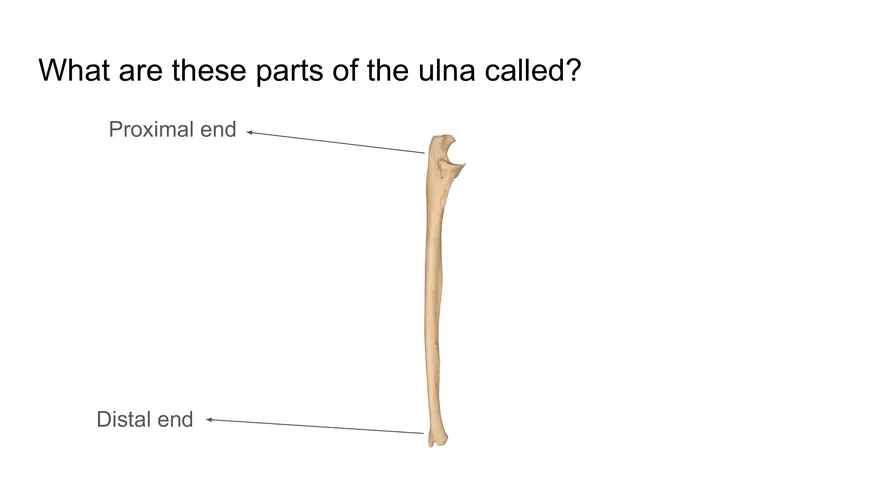 Bone Project Presentation - Page 71