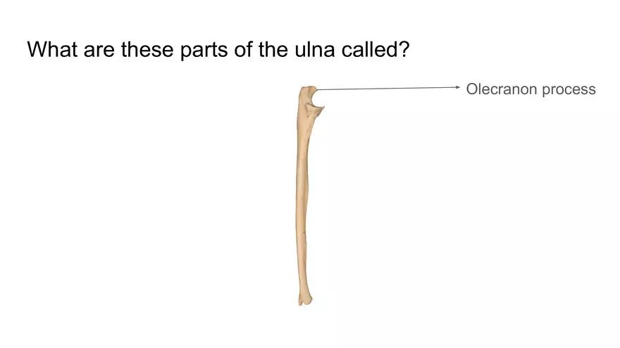 Bone Project Presentation - Page 72