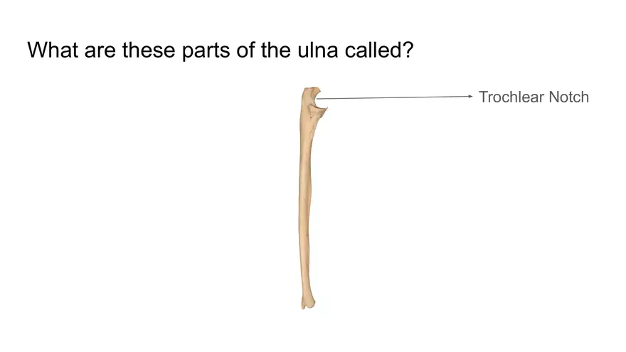 Bone Project Presentation - Page 73