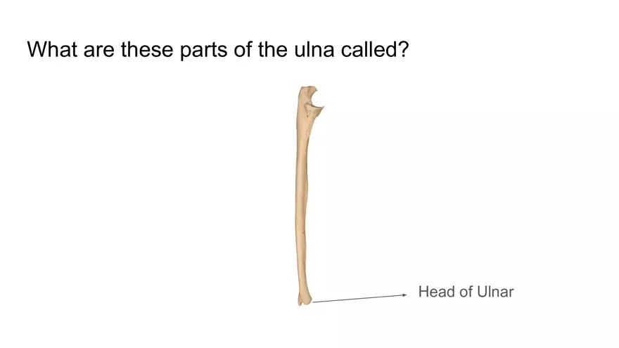 Bone Project Presentation - Page 74