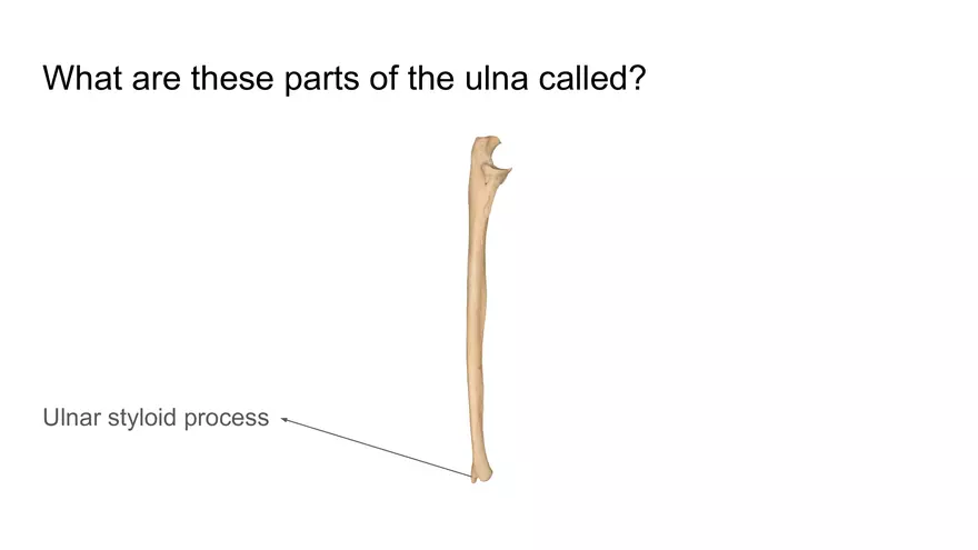 Bone Project Presentation - Page 75