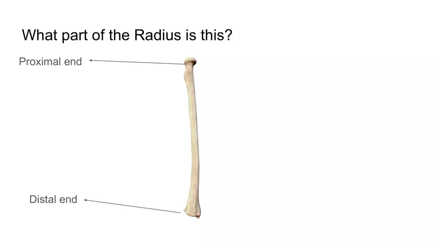 Bone Project Presentation - Page 76