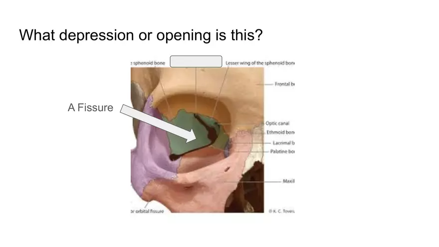 Bone Project Presentation - Page 5