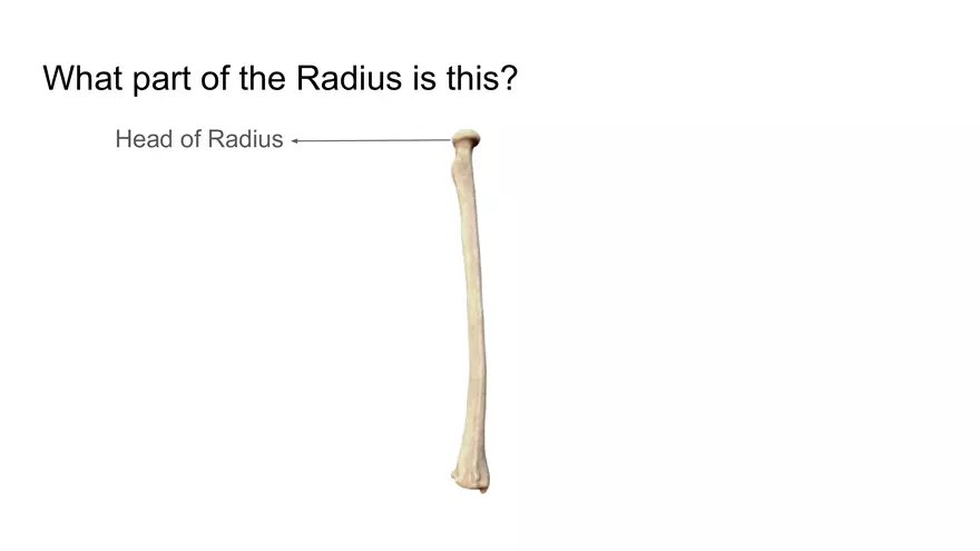 Bone Project Presentation - Page 77