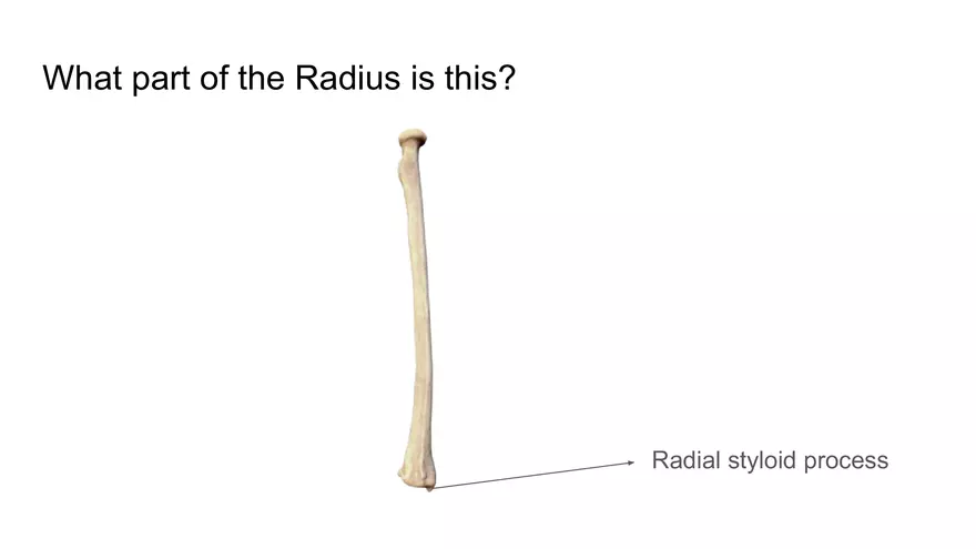 Bone Project Presentation - Page 78