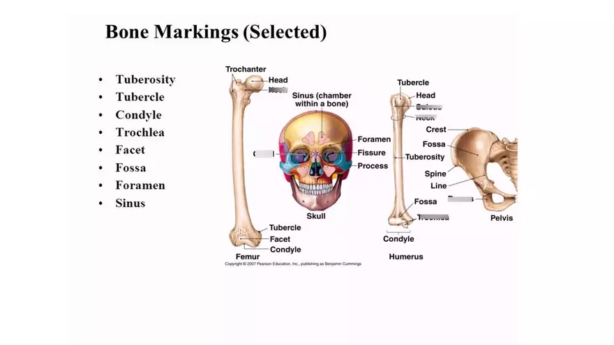 Bone Project Presentation - Page 79