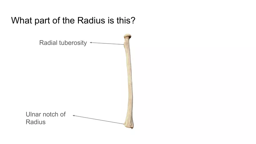 Bone Project Presentation - Page 80