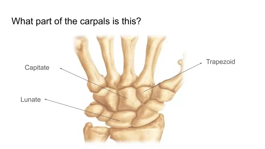 Bone Project Presentation - Page 82