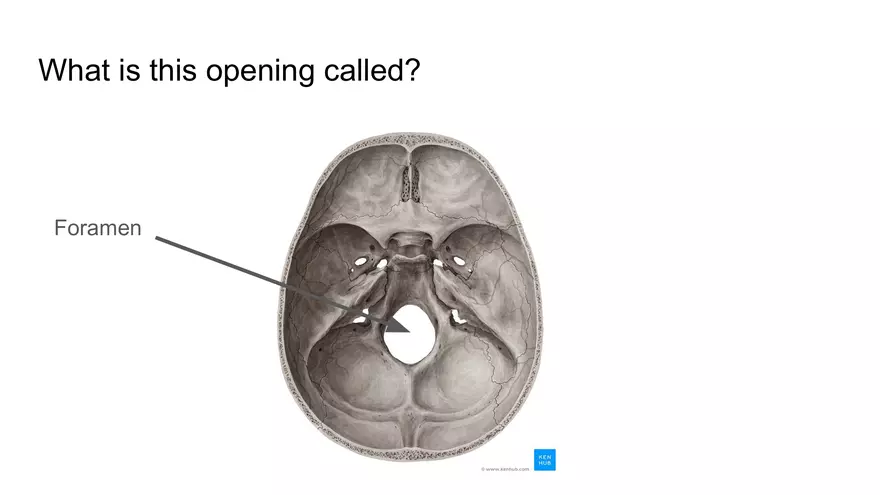 Bone Project Presentation - Page 6