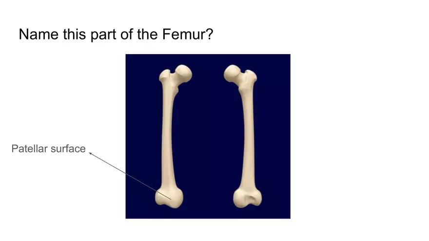 Bone Project Presentation - Page 91
