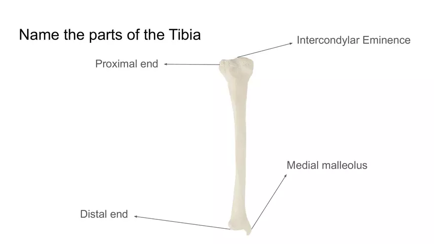 Bone Project Presentation - Page 92