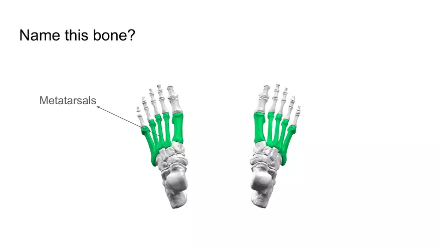 Bone Project Presentation - Page 96