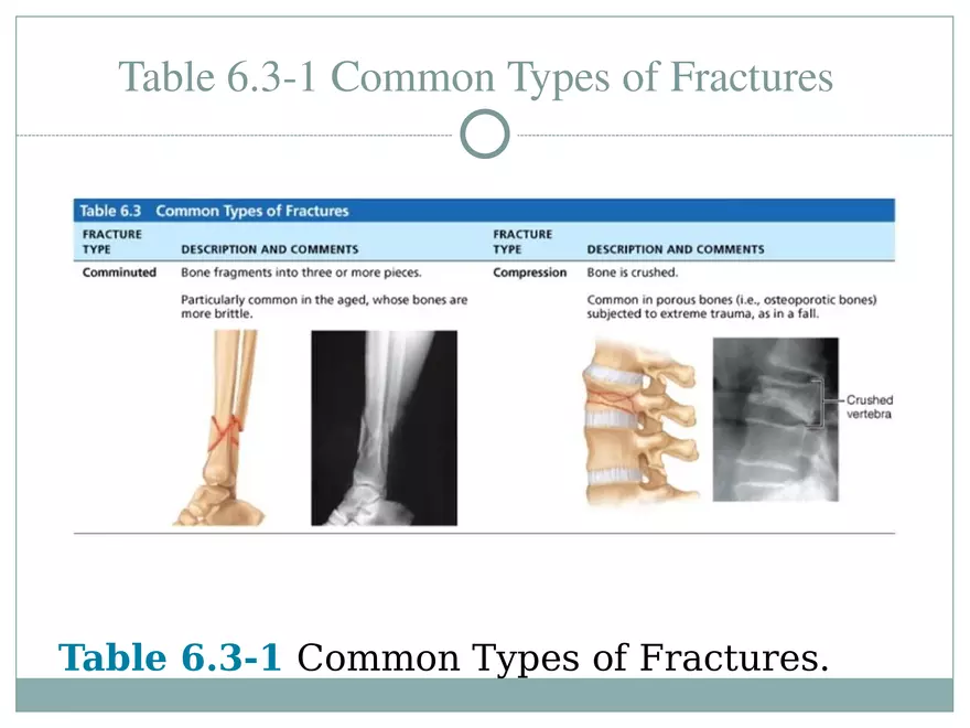 Chapter 6 Bones and Skeletal Tissue Part 2 - Page 10