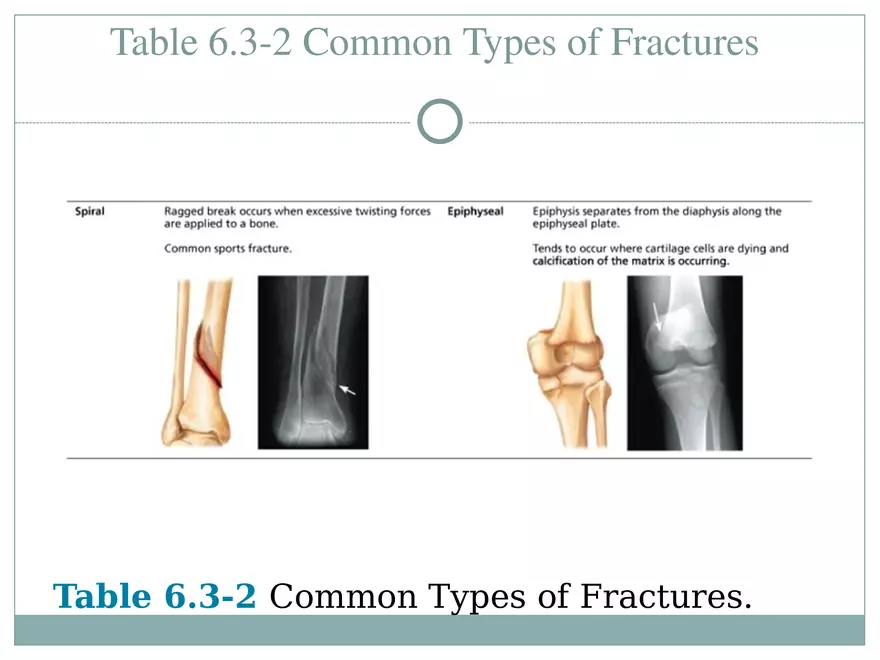 Chapter 6 Bones and Skeletal Tissue Part 2 - Page 11