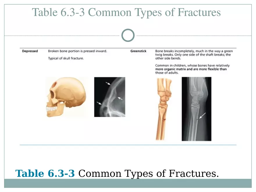 Chapter 6 Bones and Skeletal Tissue Part 2 - Page 12