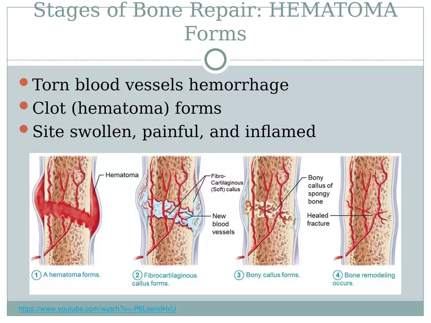 Chapter 6 Bones and Skeletal Tissue Part 2 - Page 3