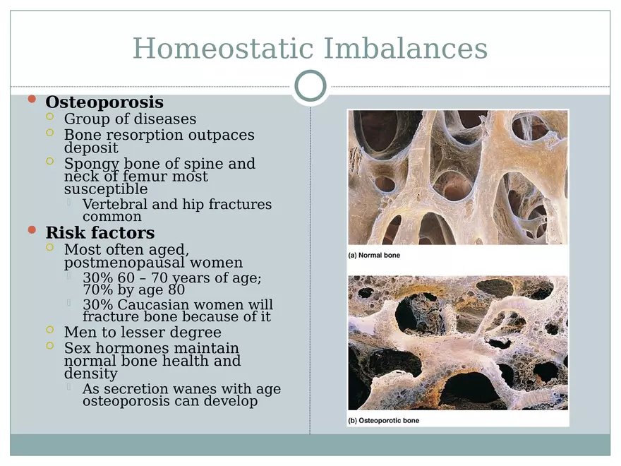 Chapter 6 Bones and Skeletal Tissue Part 2 - Page 5