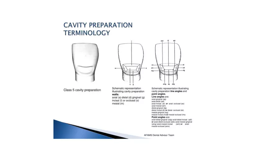 Different Designs of Class V Cavity Preparations - Page 4