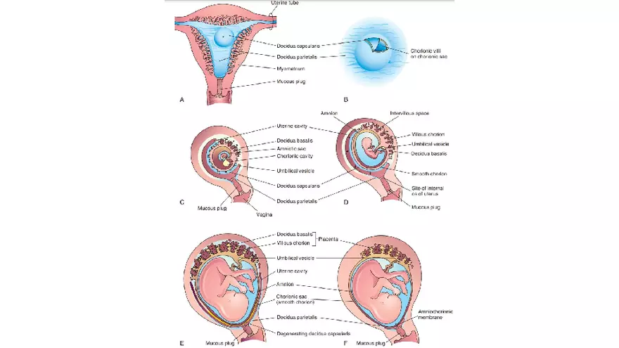 Placenta, Extraembryonic Membranes, and Multiple Pregnancies Part 1 - Page 8