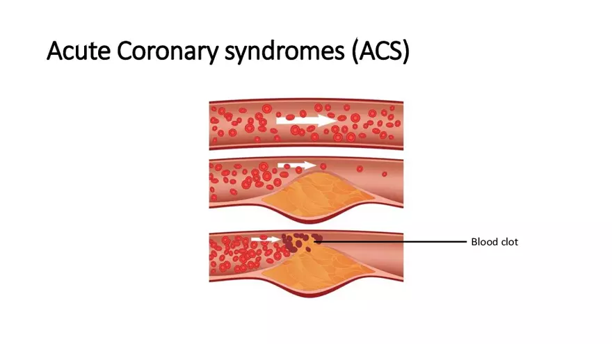Cardiovascular TBL Сycle - Page 30