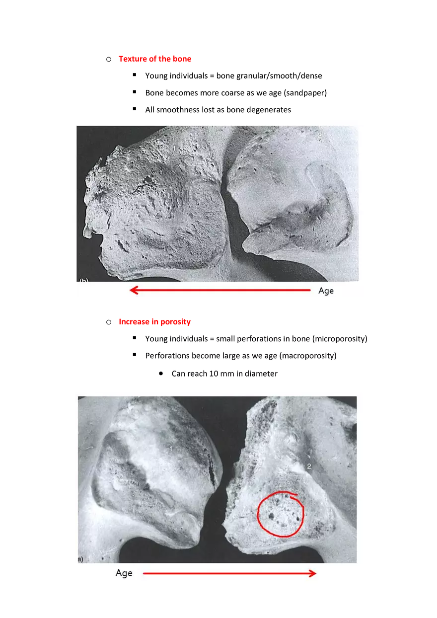 Estimation of Age at Death: The Deteriorating Skeleton - Page 9