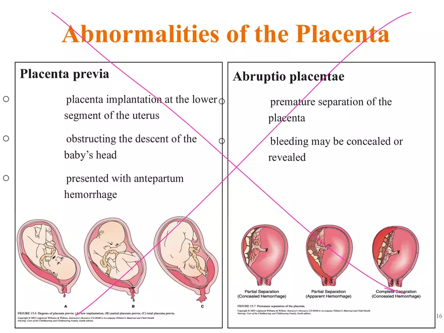 Unit 12: Lesson 1 Reproductive System - Page 25